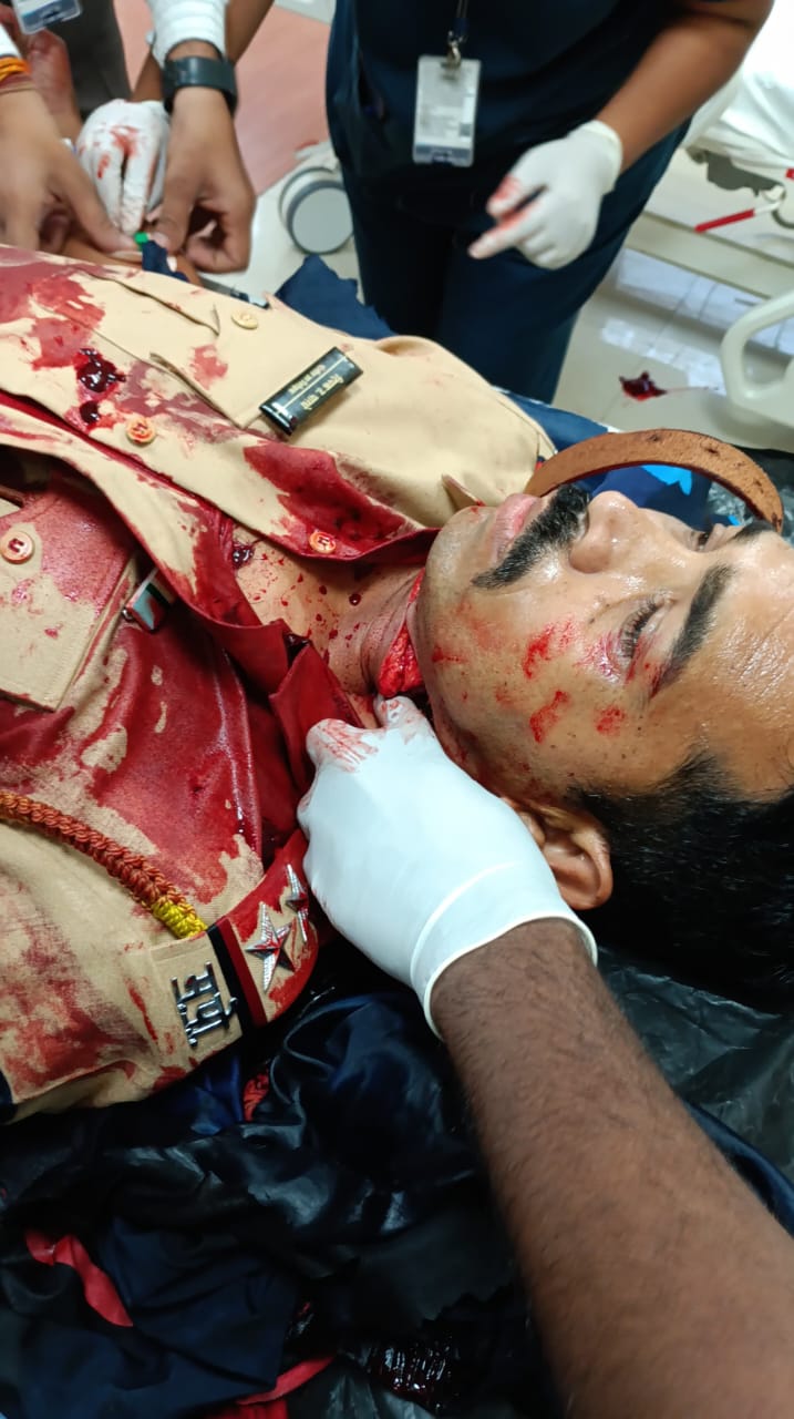 दुसरी धक्कादायक घटना! पतंगांच्या नायलॉन दोरीने पीएसआय गंभीर जखमी